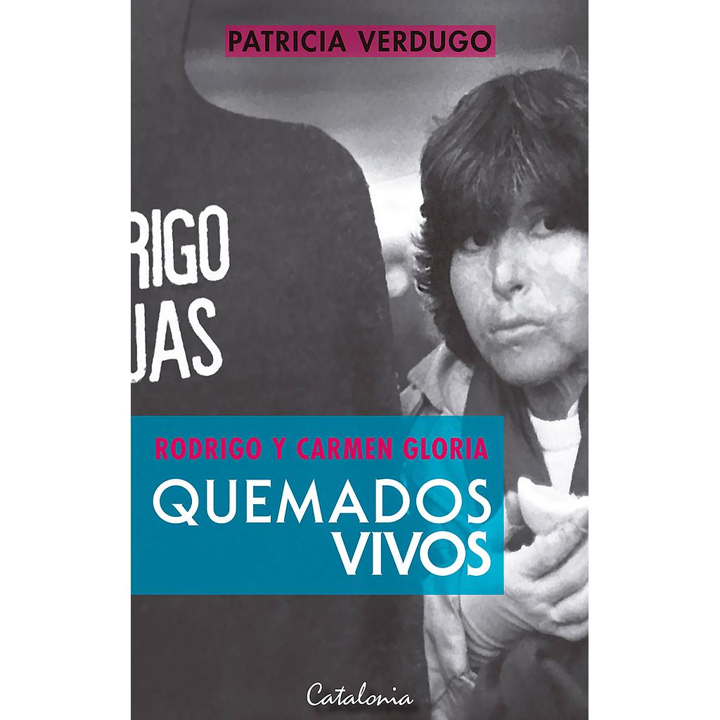 RODRIGO Y CARMEN GLORIA. QUEMADOS VIVOS